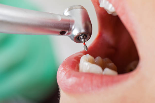 Best Dentist for Tooth Abscess  in Bradley Gardens, NJ